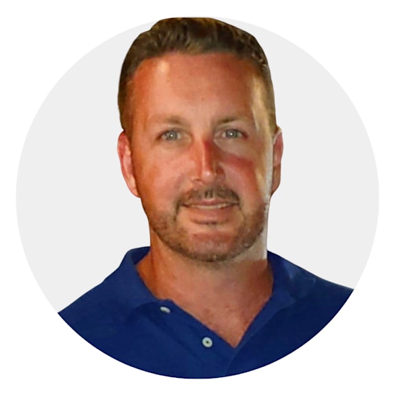 a man in a blue shirt with a acne scar on his face