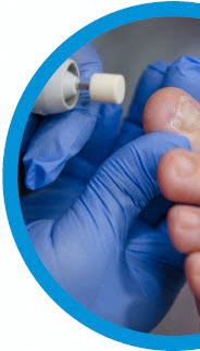 Nursing foot care services
